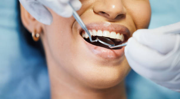 Best Emergency Dental Care for Broken or Chipped Teeth in Rio Rancho Estates, NM